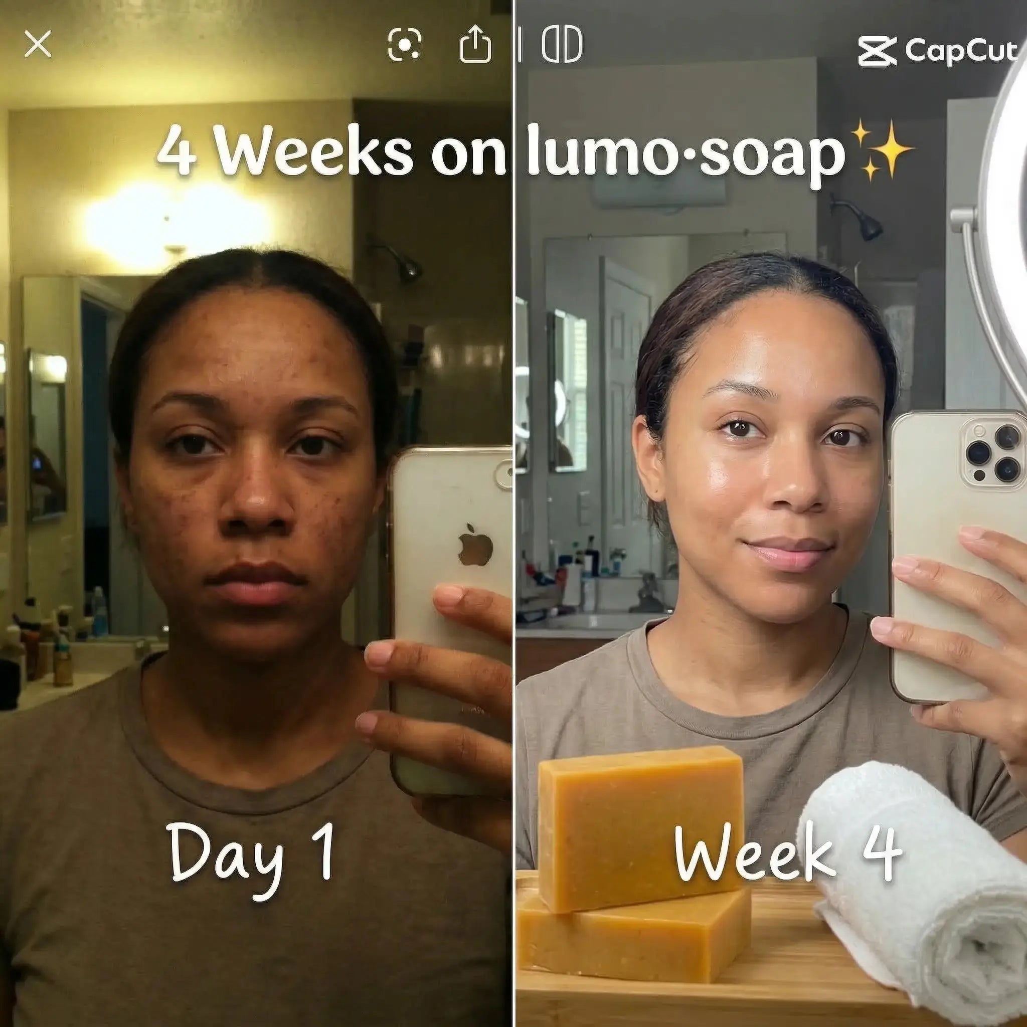 Clearer, Brighter Skin in Just 3–4 Weeks · Kojic Acid & Turmeric Soap lumosoap